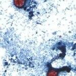 Taylor Farms recalls lettuce shipped to 27 states over cyclospora risk